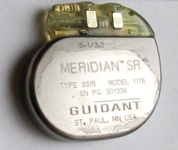File:Pacemaker.jpg