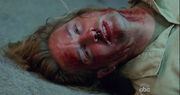 Sawyer hurts.jpg