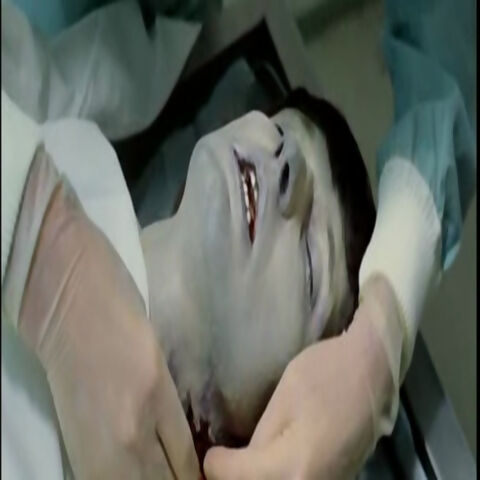 File:Autopsy.jpg