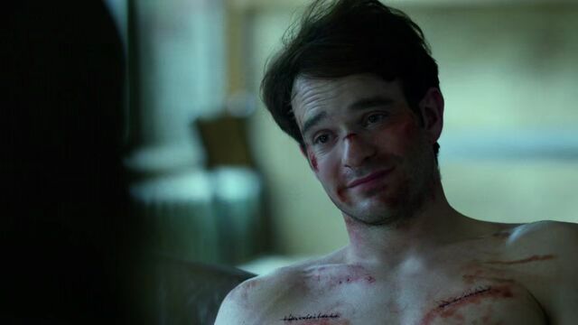 File:Matt-Murdock-Stitches-Smile.jpg
