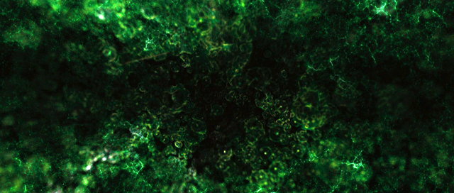 File:Gamma Radiation.png