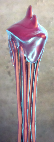 File:Opold2.png