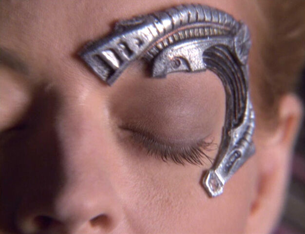 Soubor:Sevens Okularimplantat.jpg