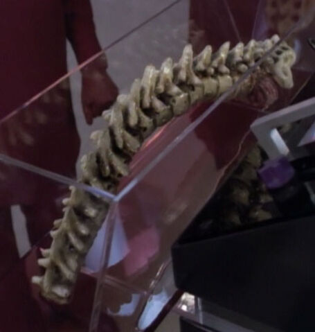 File:Klingon spinal cord.jpg