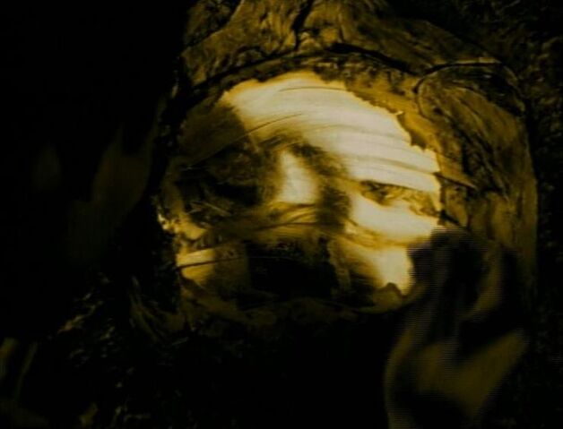 File:Kreeyan fetus.jpg