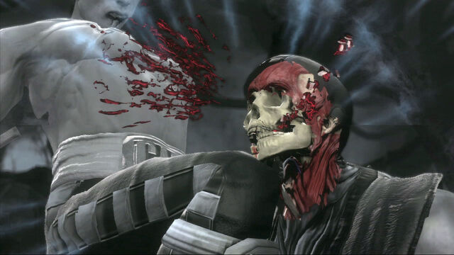File:X-Ray to the jaw.jpg