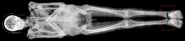 File:E3413A-xray-merged1-e1462206649609.jpg