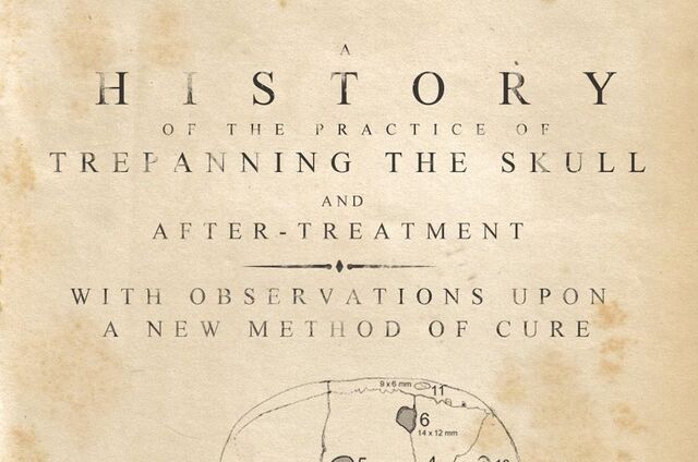 File:NOQS Trepanning.jpg