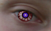 Eye3