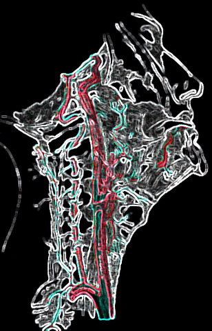 File:Artery.png