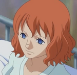 Lucian Persistent vegetative state face.png