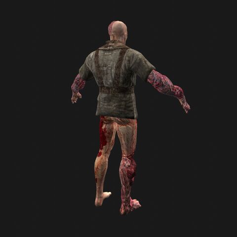File:Patient11 perspBack.jpeg