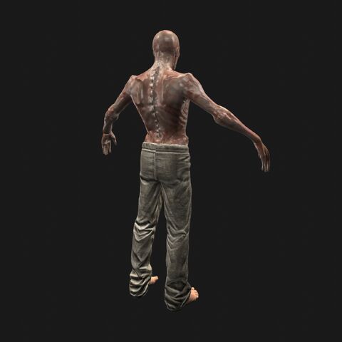 File:Patient9 perspBack.jpeg
