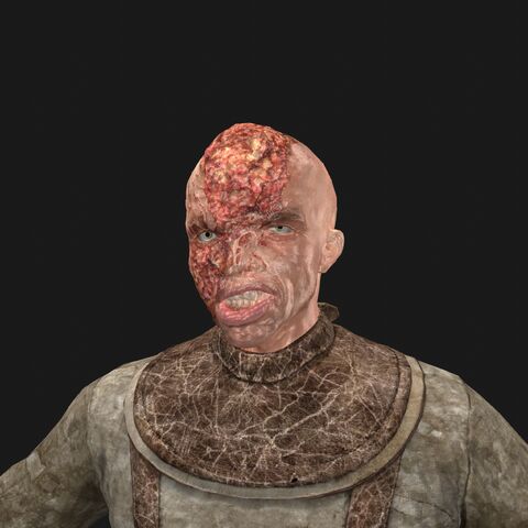 File:Patient4 face.jpeg