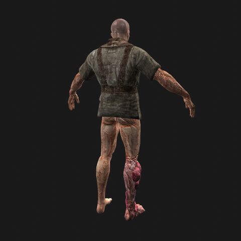 File:Patient13 perspBack.jpeg