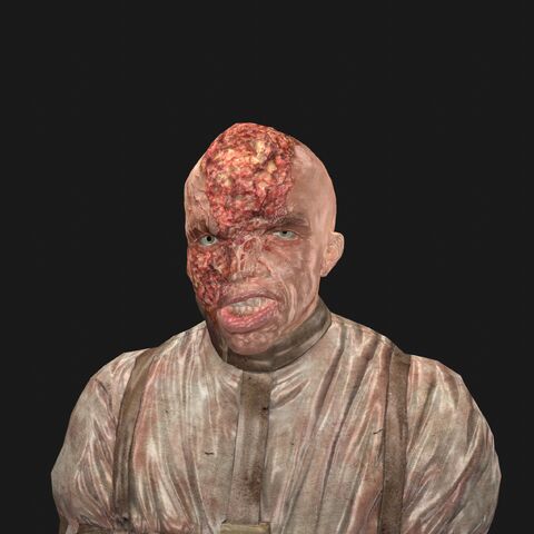 File:Patient12 face.jpeg