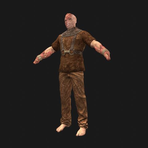 File:Patient2 perspFront.jpeg