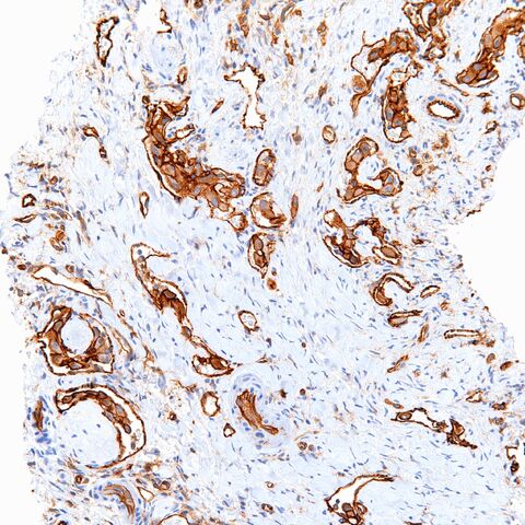 File:CD31.EHE.3.jpg