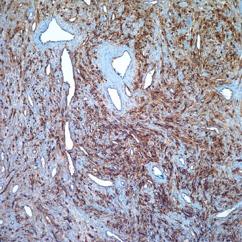 File:CD34.SFT.2.jpg