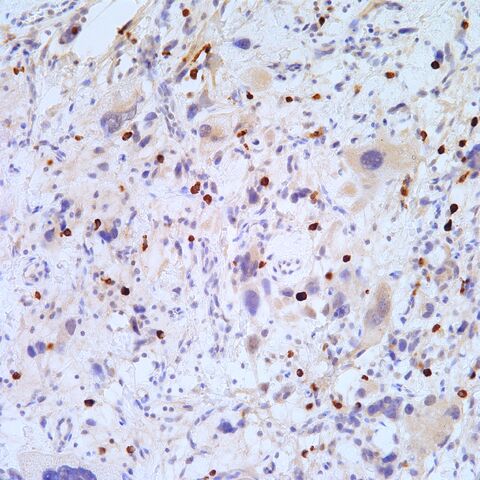 File:Myogenin.mast cells.200x.2.jpg