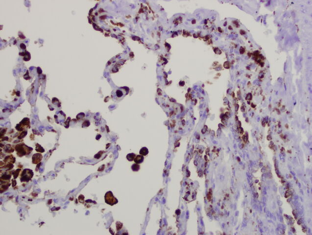 File:Napsin lung.jpg