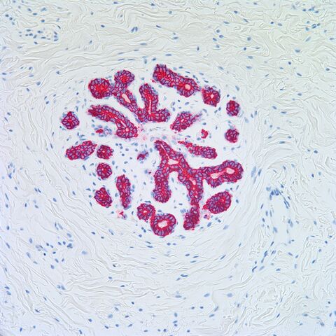 File:CAM5.2.breast lobule.jpg