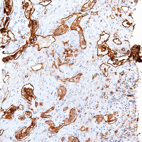 File:CD31.EHE.5.jpg