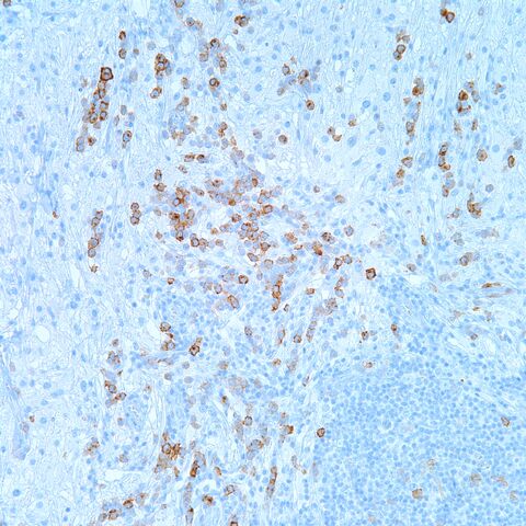 File:EMA.plasma cells.3.jpg