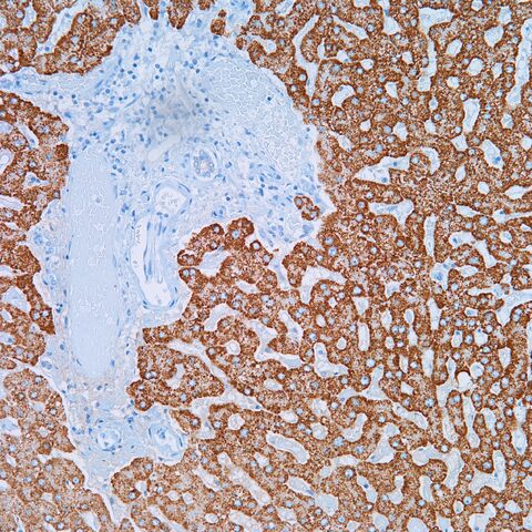 File:Heppar1.liver.4.jpg