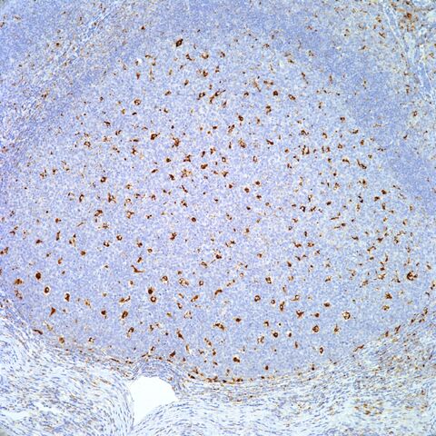 File:CD68.germinal center.100x.jpg