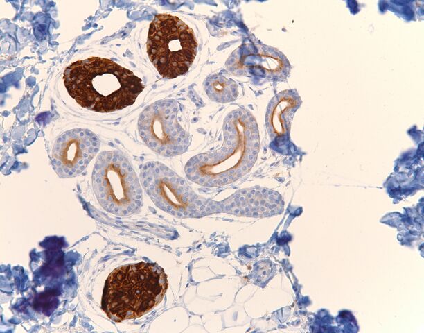 File:CK8-18.eccrine.200x.jpg