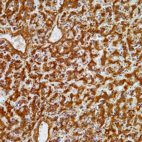 File:AFP.fetal liver.jpg