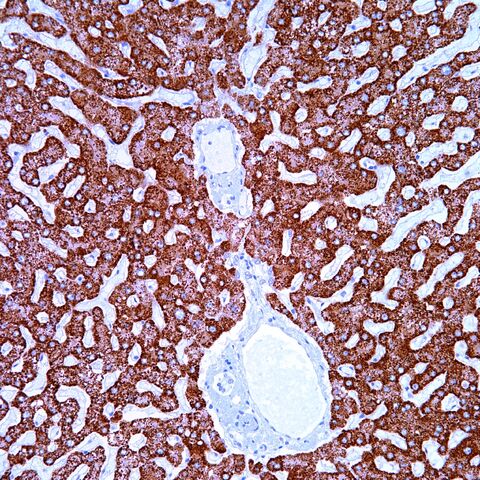 File:Heppar1.liver.5.jpg
