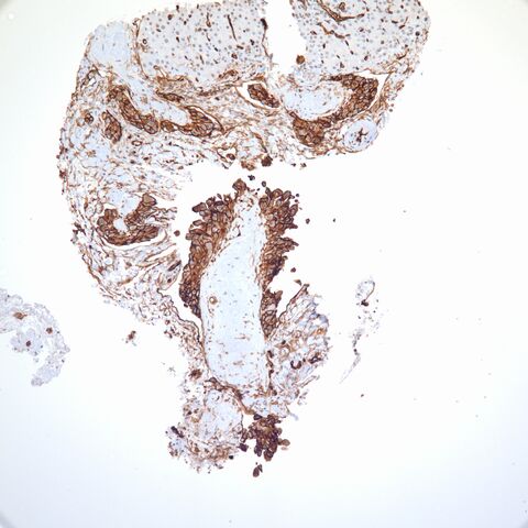 File:CD34.EHE.8.jpg