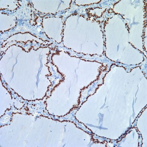 File:TTF-1.thyroid.jpg