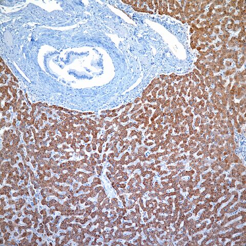 File:Heppar1.liver.3.jpg