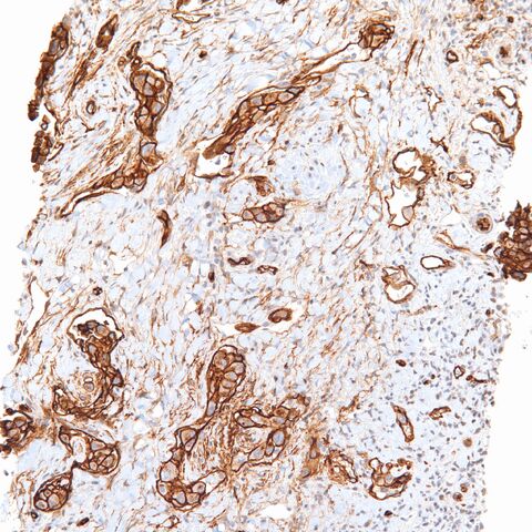 File:CD34.EHE.3.jpg