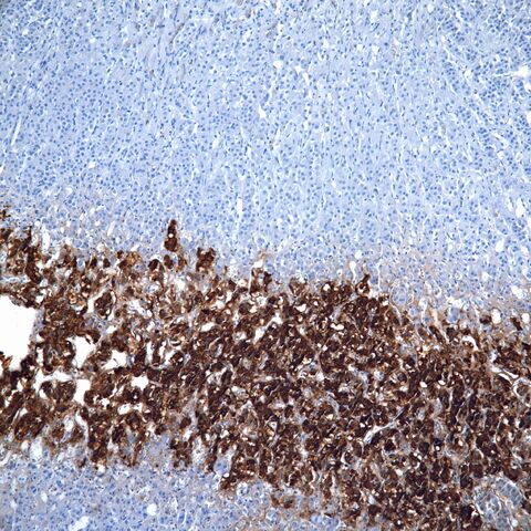 File:Chromogranin.adrenal medulla.jpg