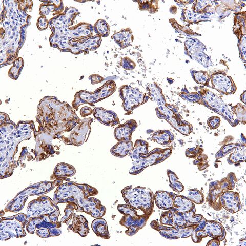 File:CD10.placenta.2.jpg