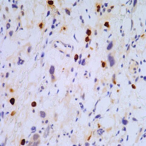 File:Myogenin.mast cells.400x.3.jpg