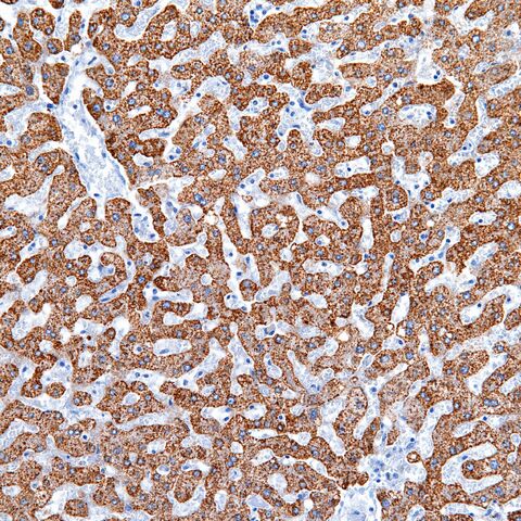 File:Heppar1.liver.2.jpg