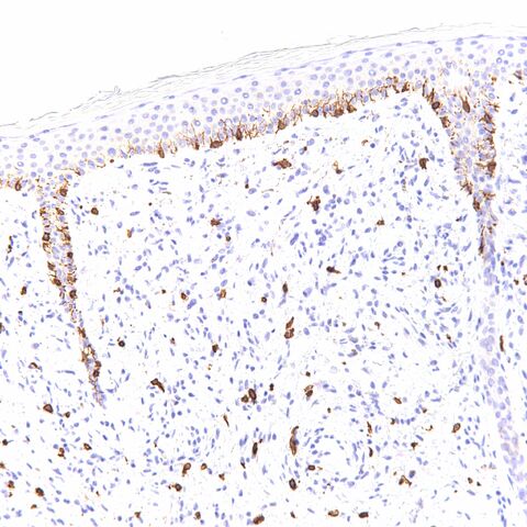File:CD117.melanocytes.200x.jpg