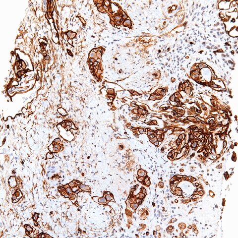 File:CD34.EHE.4.jpg
