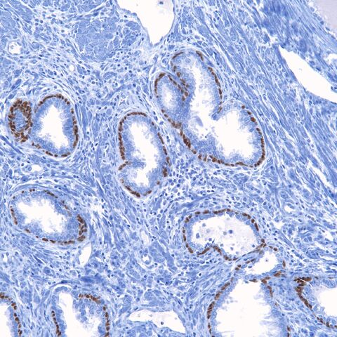 File:P63.prostate.jpg