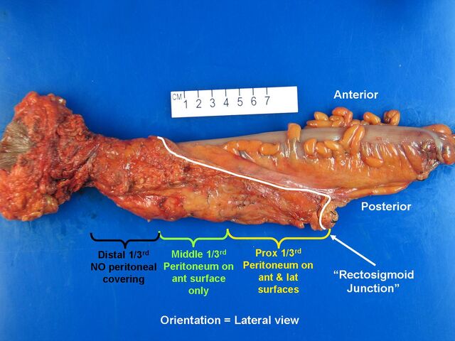 File:Rectum lateral view.jpg