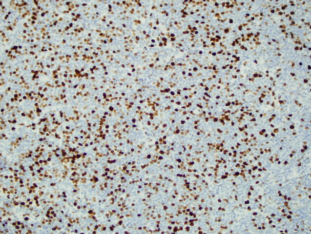 File:Ki67.jpg