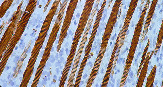 File:Cropped Desmin.skeletal muscle striations.400x.jpg