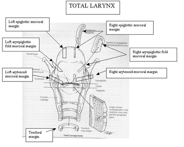 File:Laryngectomy sections.jpg