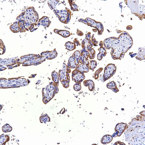 File:CD10.placenta.1.jpg