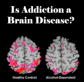 Difference between gambling addiction and drug addiction